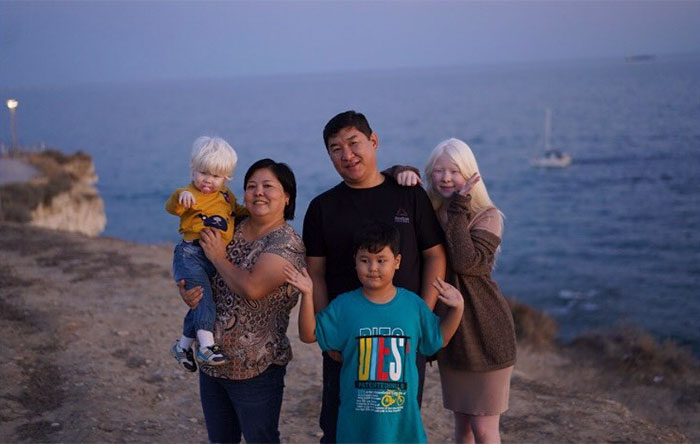 albino hermanas 19
