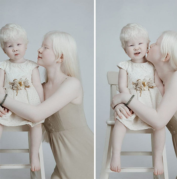 albino hermanas 2