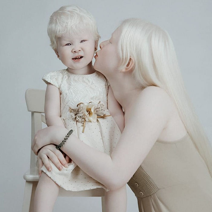 albino hermanas 3