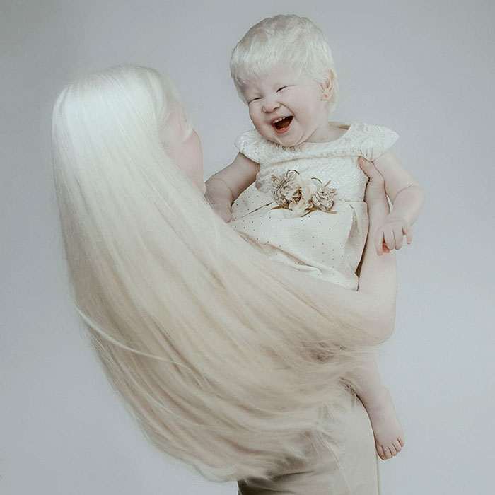 albino hermanas 8