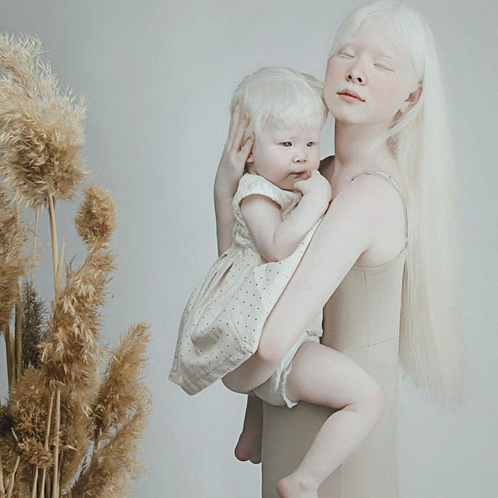 albino hermanas 9