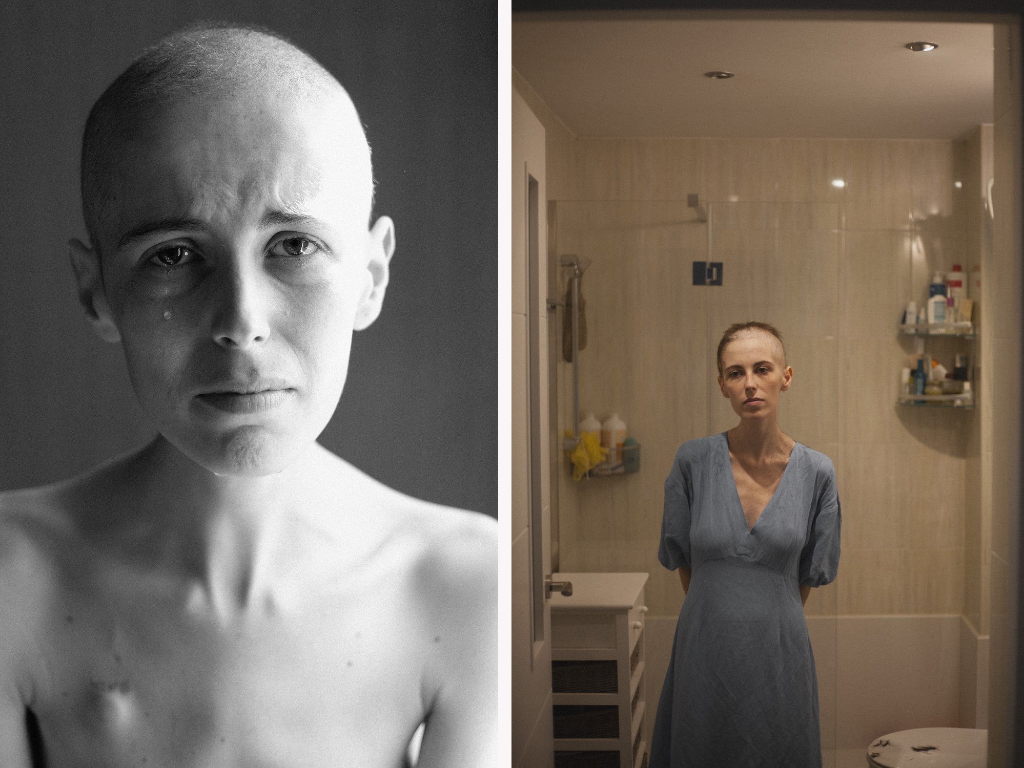 La fotógrafa Olatz Vázquez documenta su enfermedad en estas bellas y duras imágenes