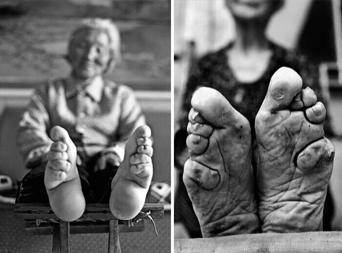 barbaridades en nombre de la belleza9
