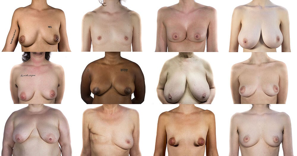 Berta García-Lacht, proyecto tetas