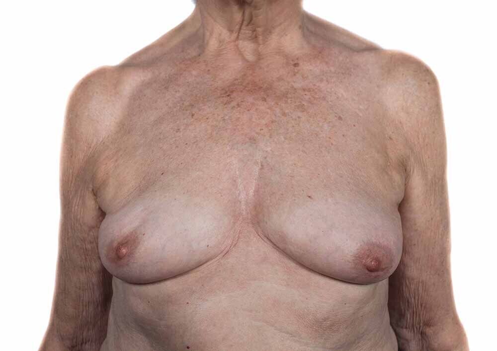 Berta García-Lacht, proyecto tetas