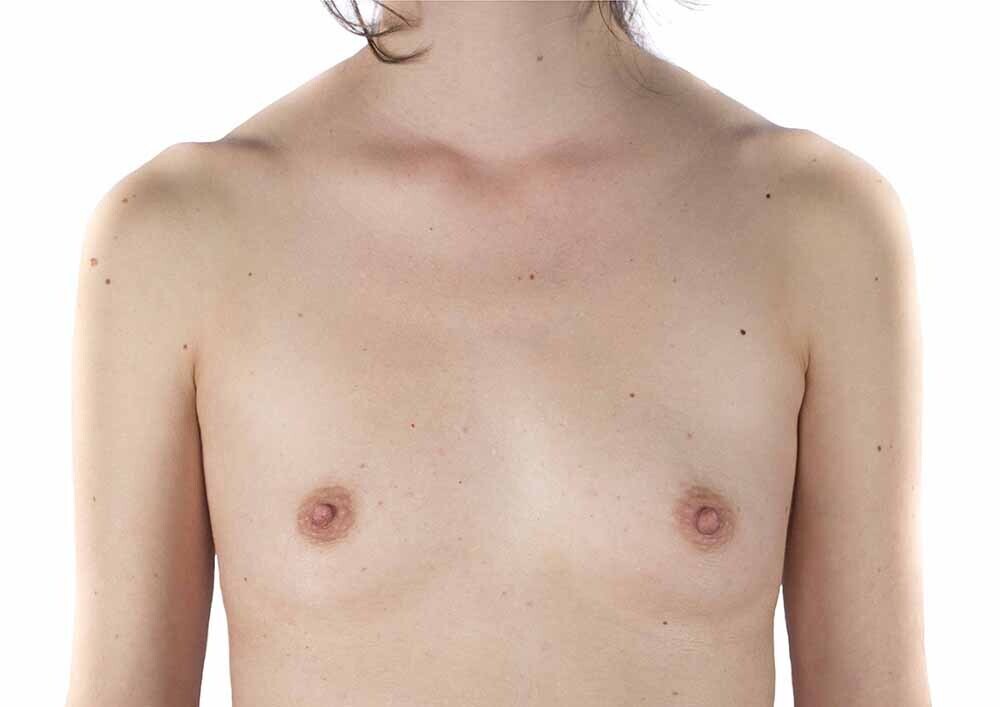 Berta García-Lacht, proyecto tetas