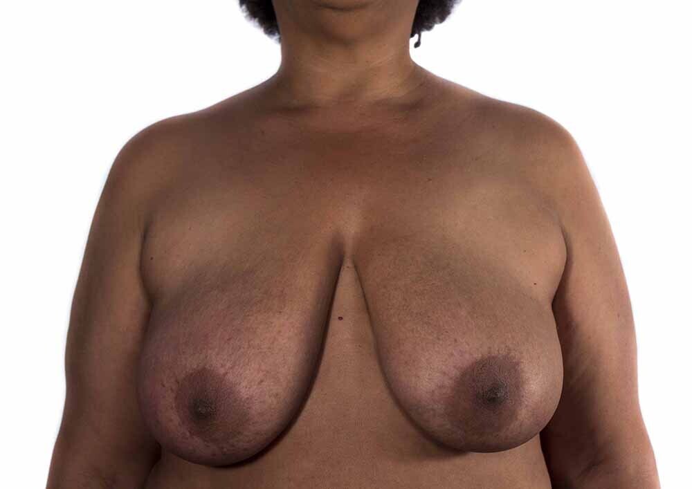 Berta García-Lacht, proyecto tetas